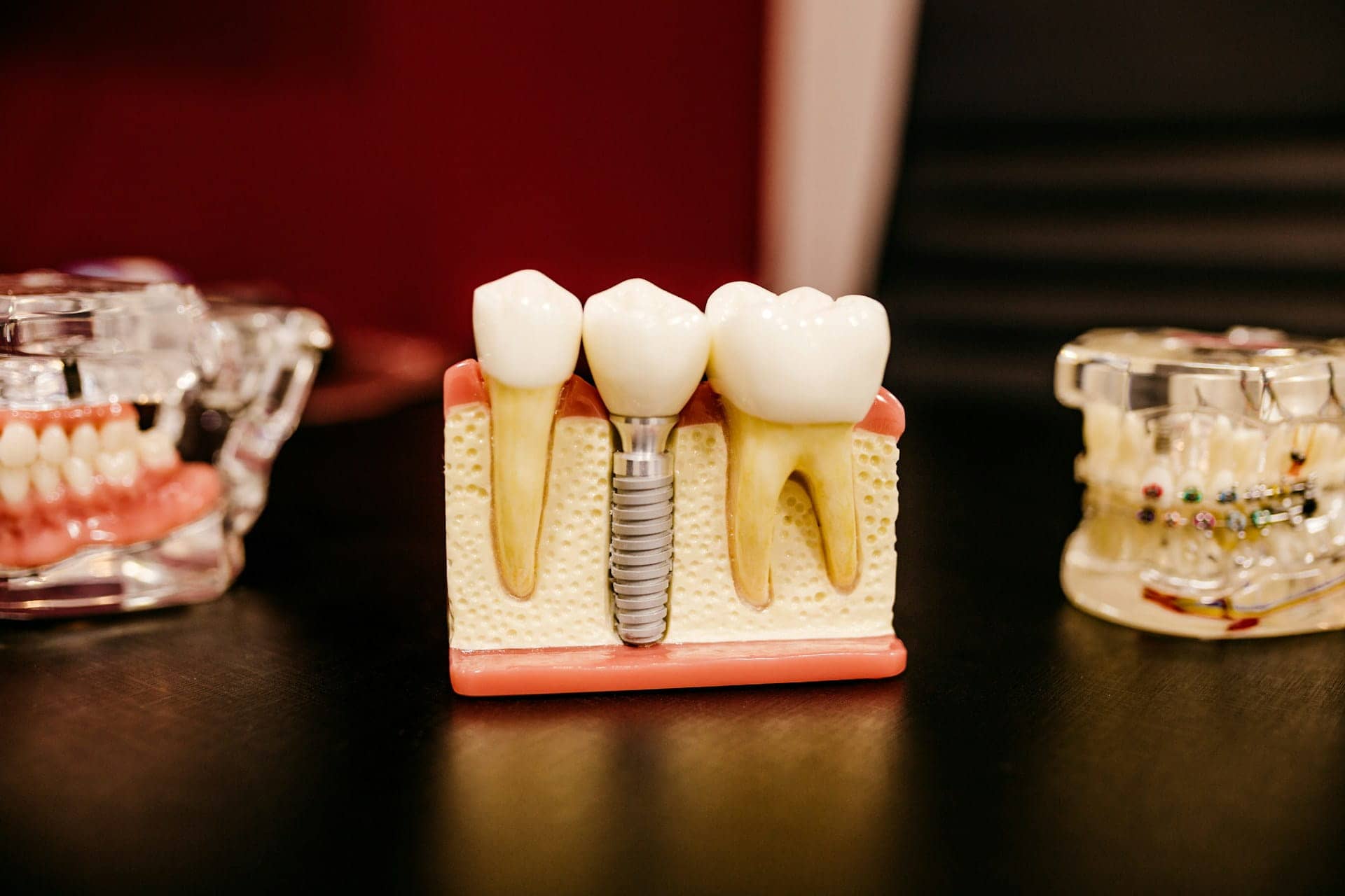 Affordable Dental Implants: Options for Seniors