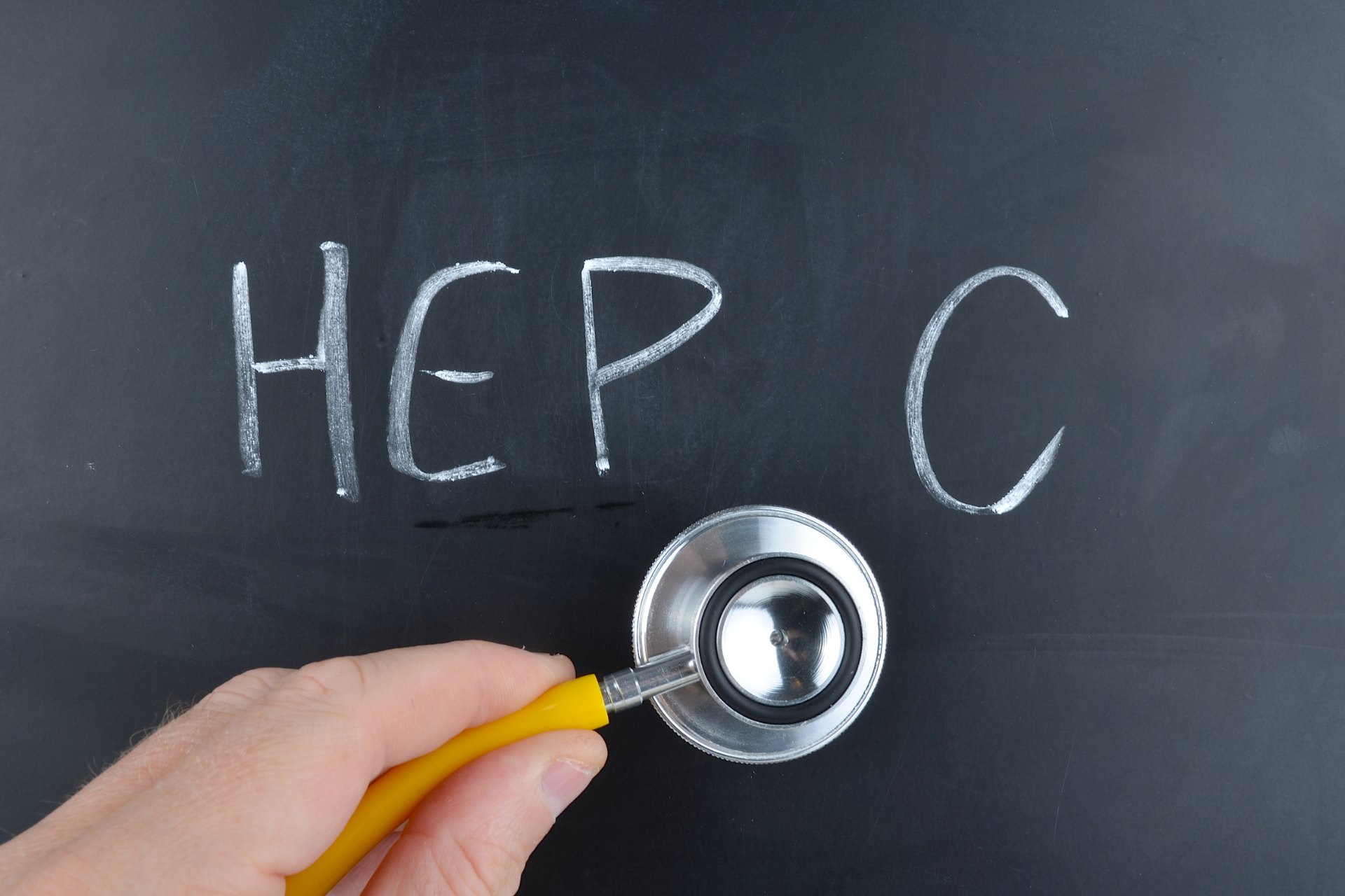 Hepatitis C: Recognize the Signs and Symptoms